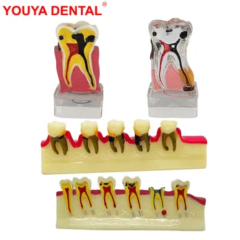 Стоматологическая Модель зубов Модель заболеваний пародонта Стоматологическая модель зубов Пародонтит для изучения преподавания демонстрации образования